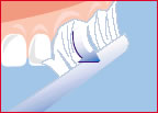 Teeth_cleaning_1.jpg