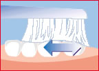 Teeth_cleaning_4.jpg