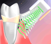 brush_anytime_flash.gif